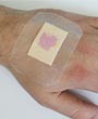 Bandages change colour if infection occurs