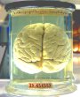 Google Science Fair lauds artificial brain